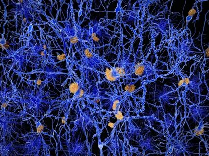 Ученые: белки-кластерины могут помочь при болезни Альцгеймера