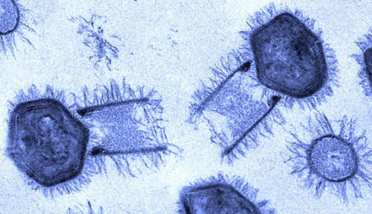 Древний вирус из вечной мерзлоты почти 50-тысячелетней давности оказался способным заражать живые клетки
