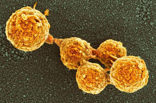 Синтетическая клетка может расти и размножаться, подобно бактериям